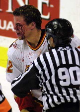 We've Got a Bleeder